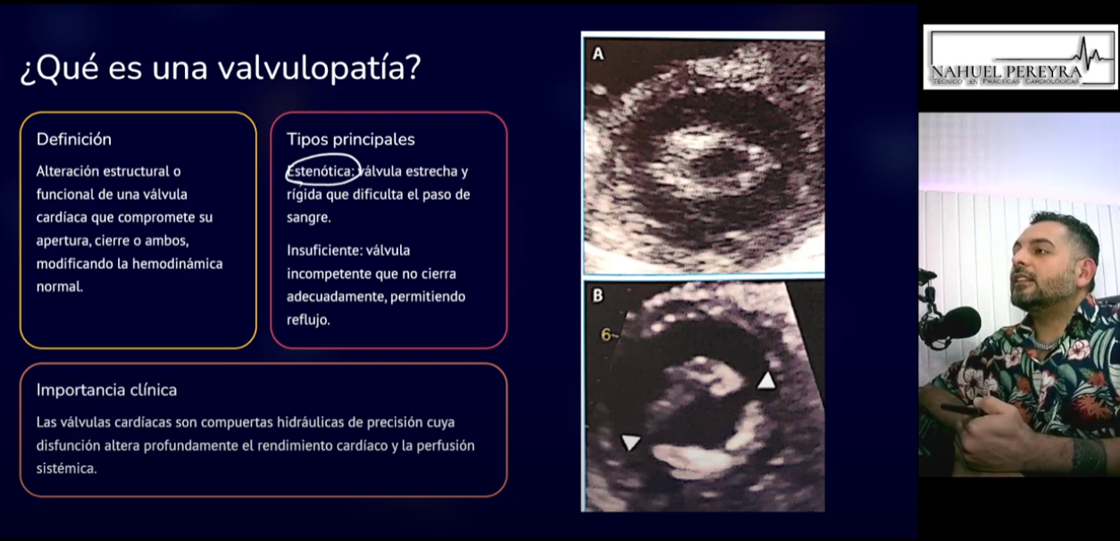 Curso Ecocardiografía